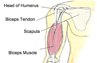 Physio for Biceps Tendinopathy
