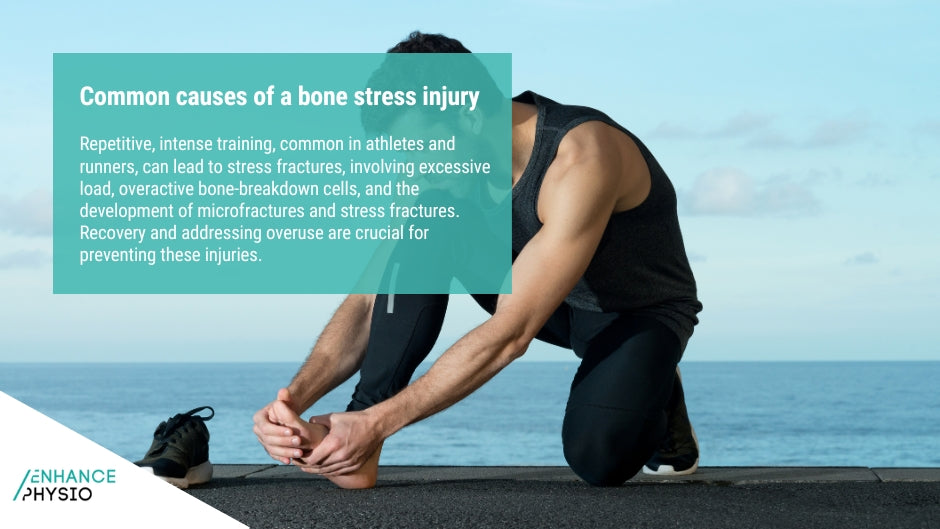 Physiotherapy For Bone Stress Injuries