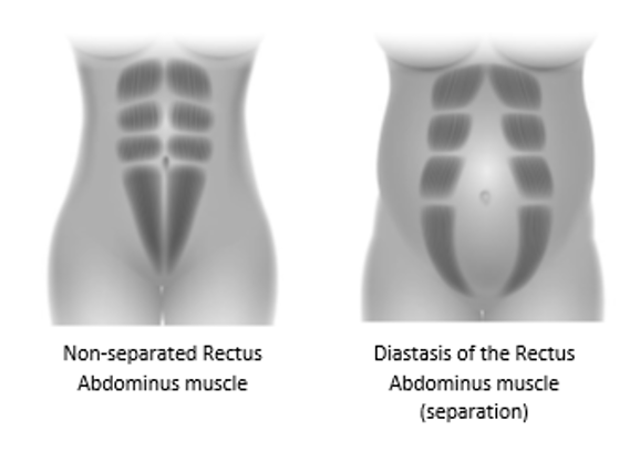 DRAM in Pregnancy & the Postpartum Period