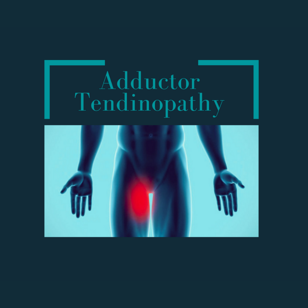 Physiotherapy For Adductor Tendinopathy
