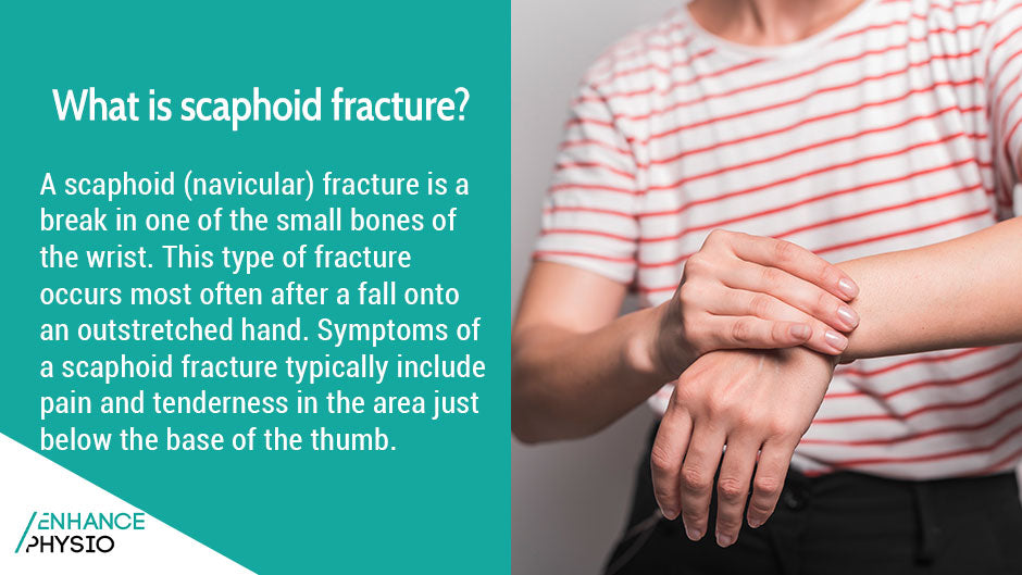 Physiotherapy for Scaphoid Fractures