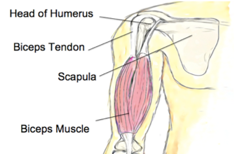 Biceps Tendinopathy - Enhance Physiotherapy