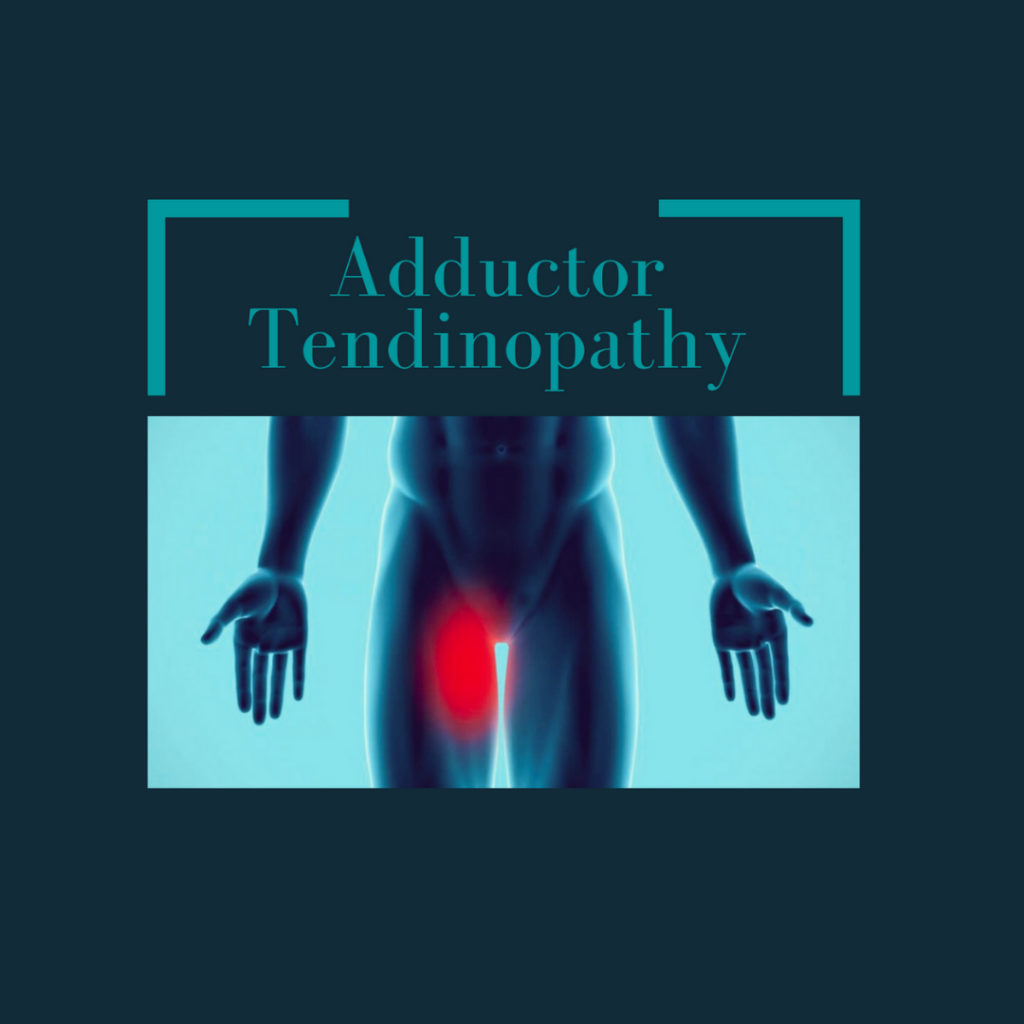 Physiotherapy For Adductor Tendinopathy
