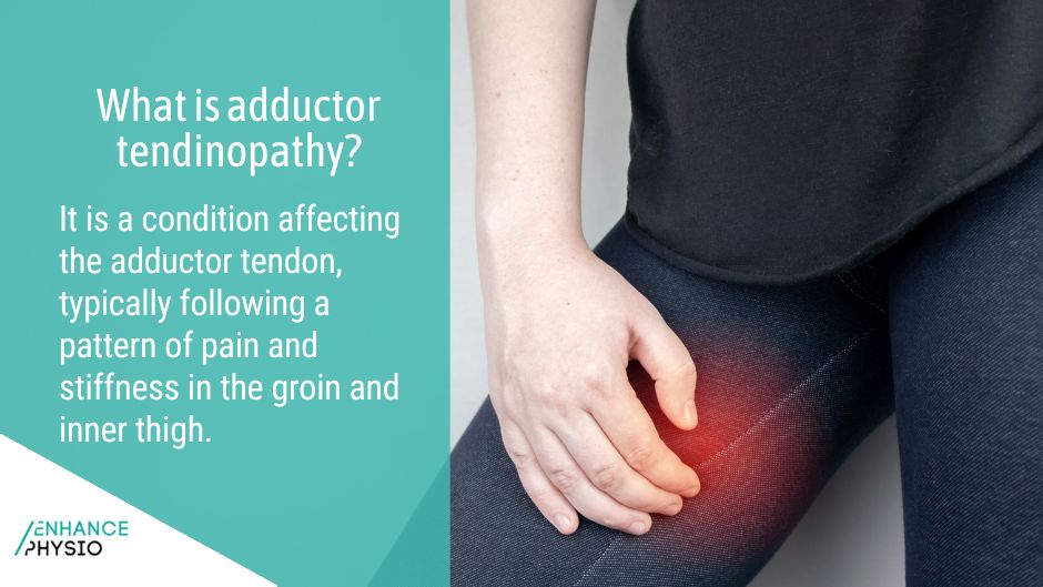 Physiotherapy For Adductor Tendinopathy