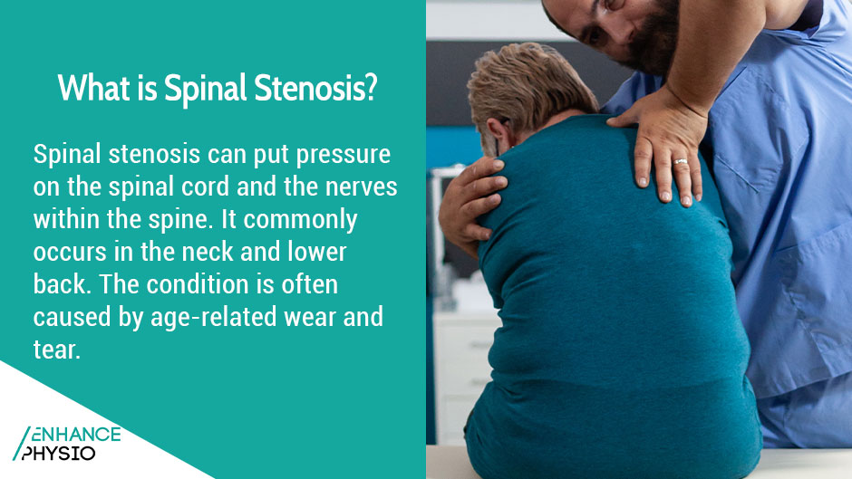 Physiotherapy for Spinal Stenosis